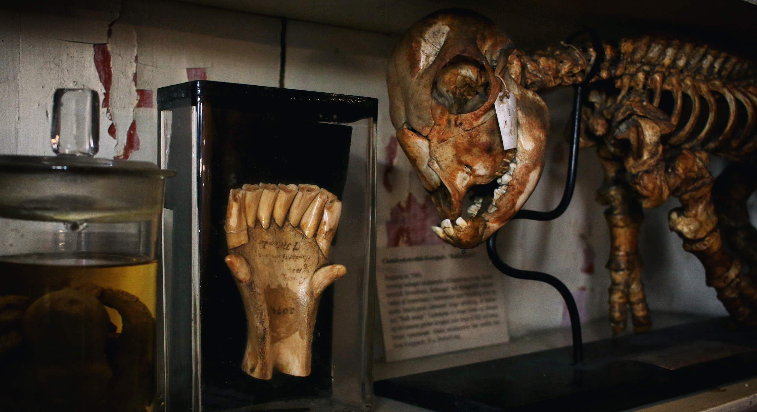 skeletpræparat fra den patologiske samling